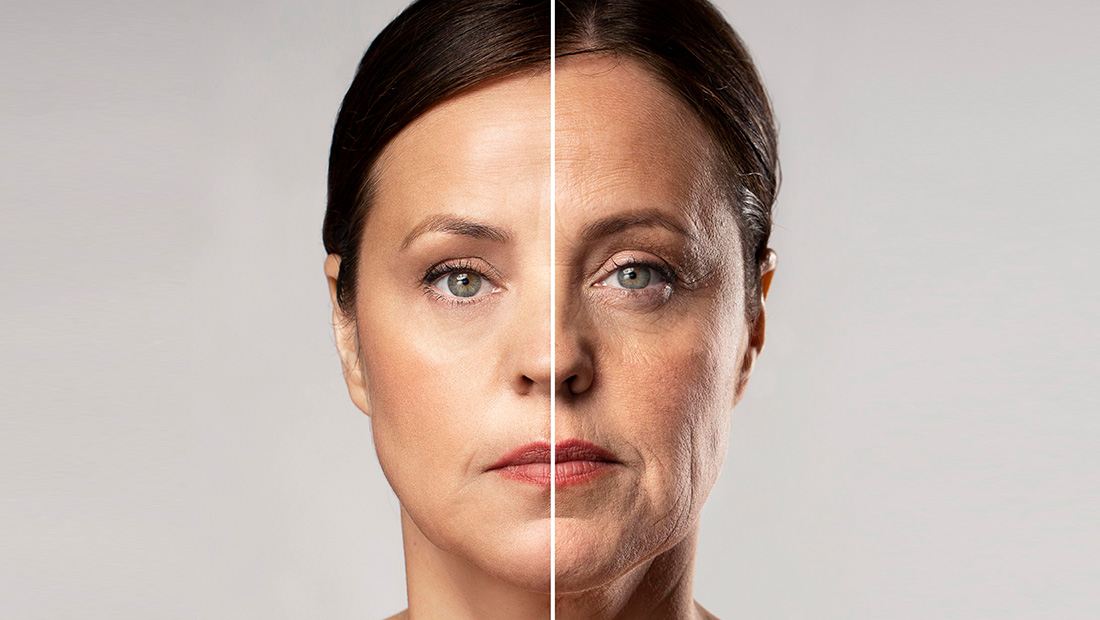 Orta Yüz Dolgusu (Mid-Face Filler)