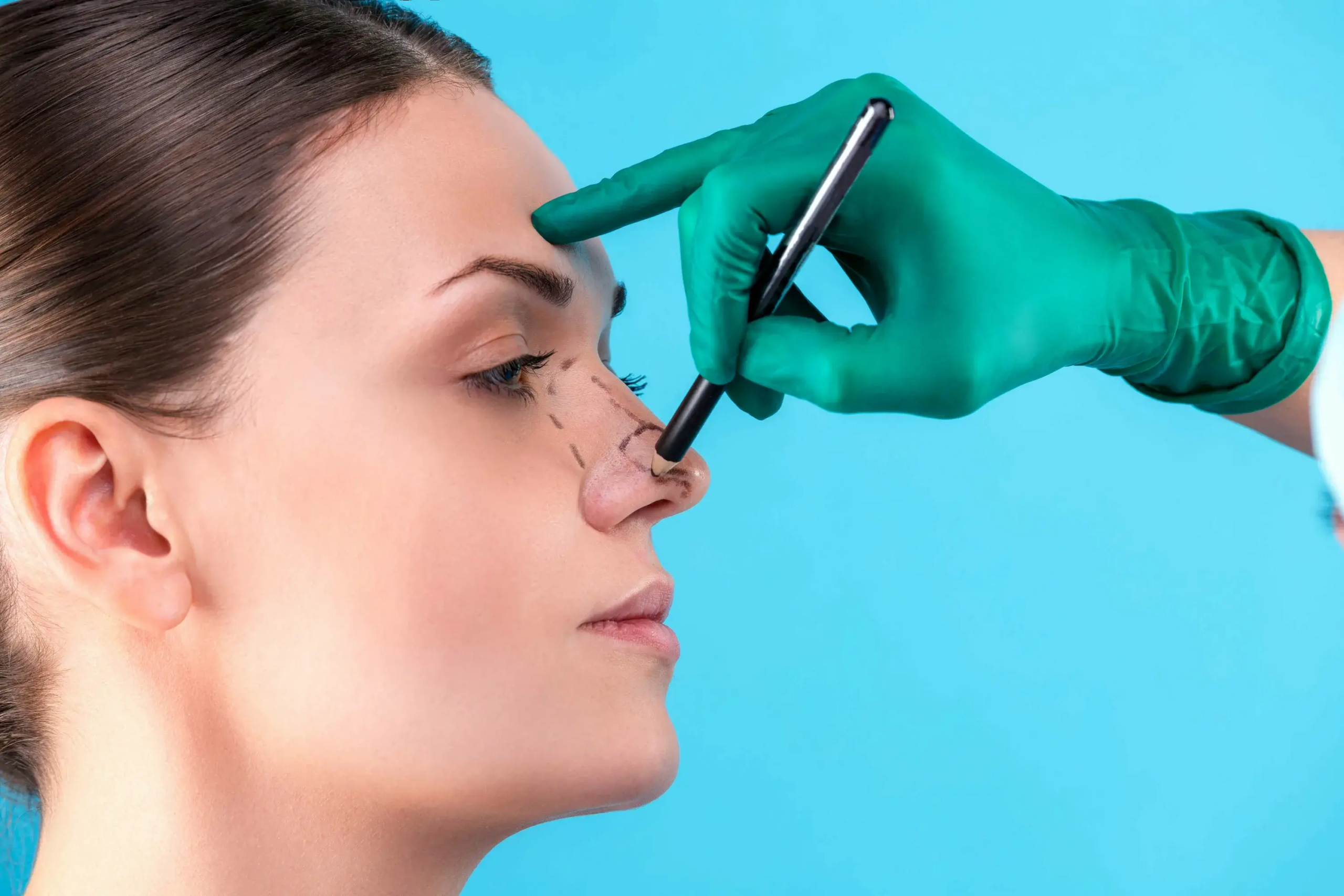 Kapalı Burun Estetiği (Closed Rhinoplasty)